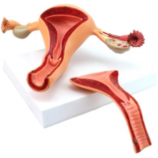 Internal Female Reproductive Organs, J-Type