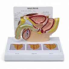 Male Pelvis Model w/Prostate Cross-Sections