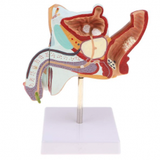 Pathological Model of the Male Urogenital System, 2 Parts