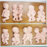 Deformities in infants, 8-parts
