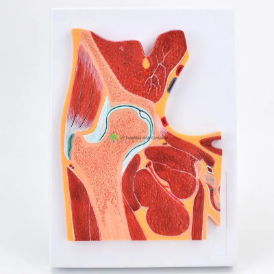 MRI hip joint model