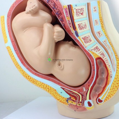 怀孕骨盆与成熟的胎儿，2部件