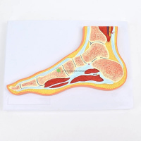 MRI foot joint model