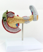 Liver Section with Gall Bladder Pathology model