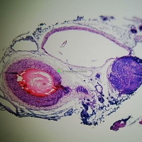 Microscope slide (Artery & Vein)