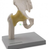 Hip Joint, life size, size: 17x 14 x 17cm