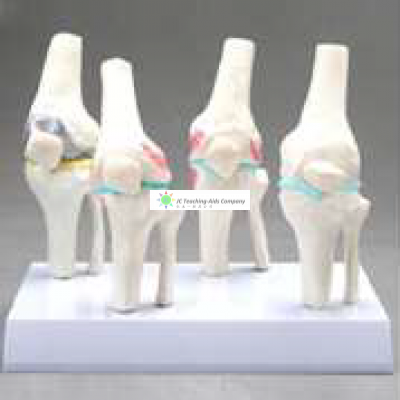 Knee Joint Set