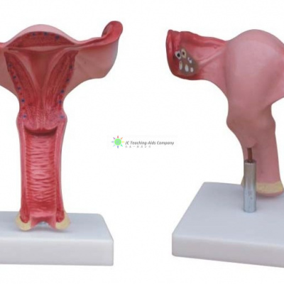 Internal Female Reproductive Organs