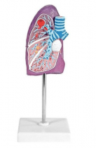Pathological Model of the Lung