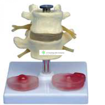 2 Lumbar Vertebrae