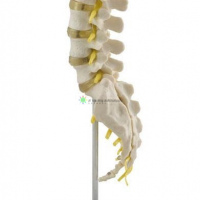 Lumbar Spinal Column with Sacral