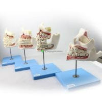 Dentition Development, Set of 4