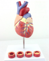 Human Heart and Thrombosis Model, 2 Parts