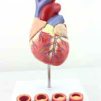 Human Heart and Thrombosis Model, 2 Parts